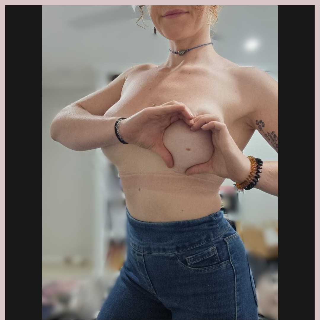 Photograph 3 from Hope’s story
